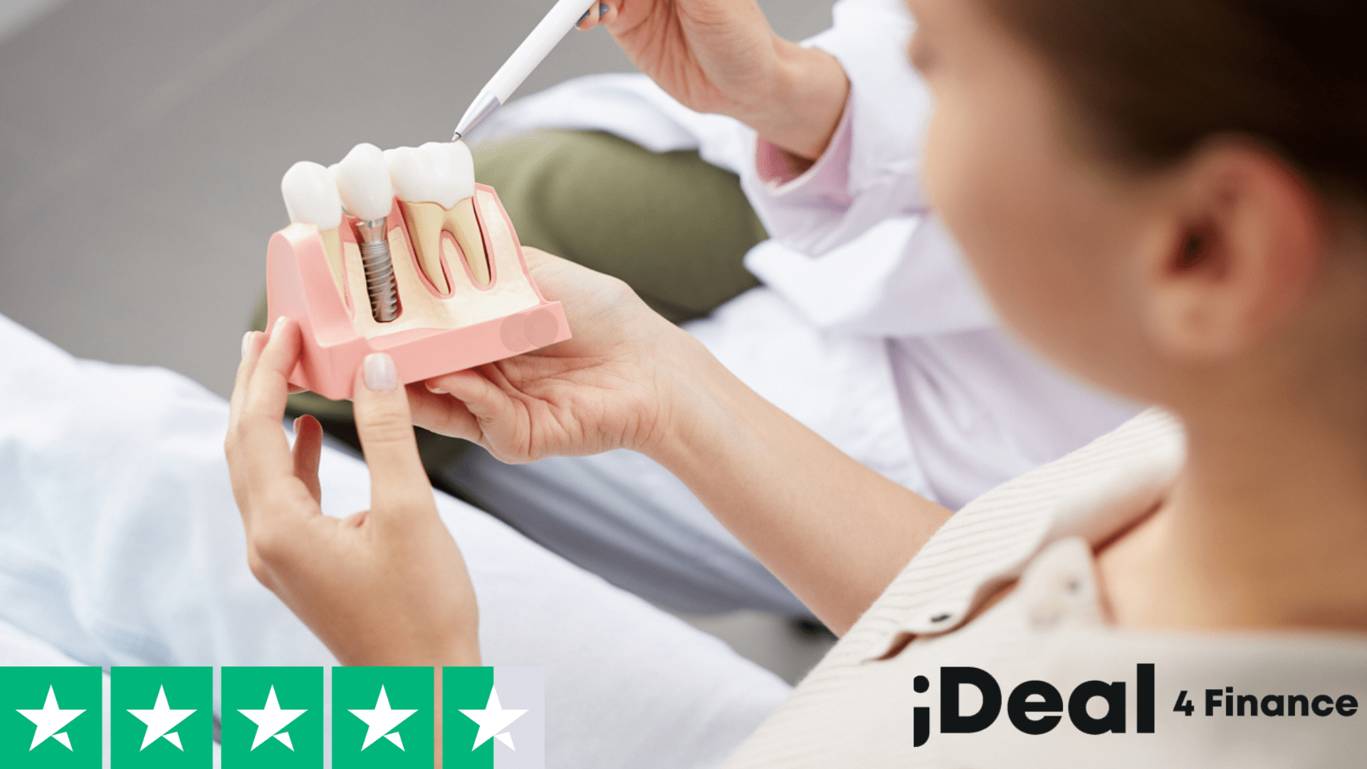 dental implants finance